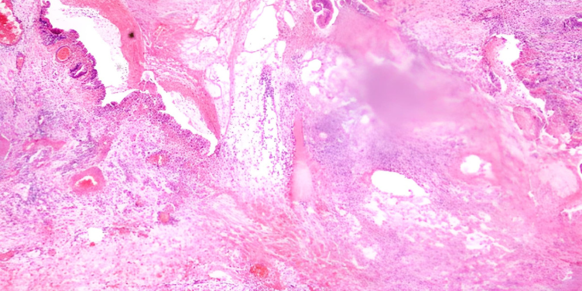 Innovations and Market Outlook in BRAF-Targeted Oncology Therapies